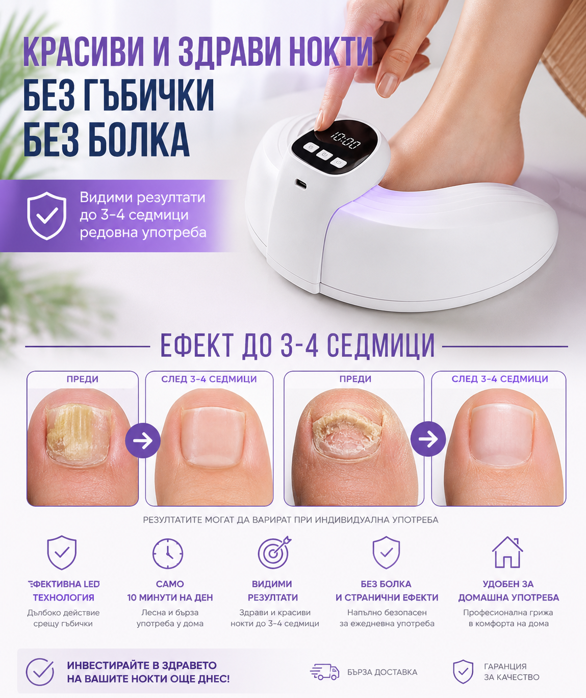 LED лампа за лечение на гъбички по ноктите