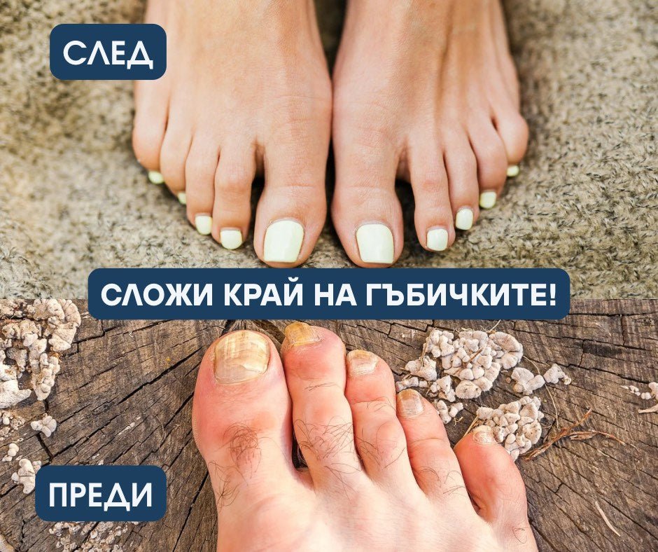 Reflect™ LED устройство за възстановяване на здрав вид на ноктите - RFLCT - Онлайн магазин